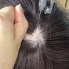植毛(+25,000円)
