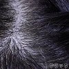 髪の毛の植毛（硬質シリコンヘッド限定）(+25,000円)