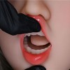 口開閉機能あり（軟性シリコン材質限定）